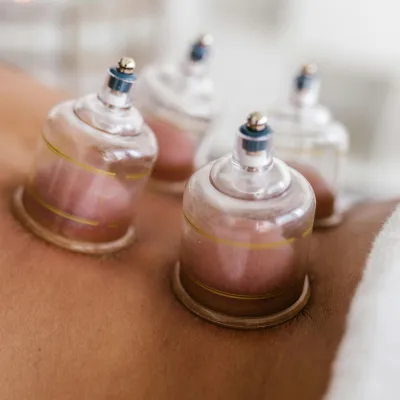 Cupping